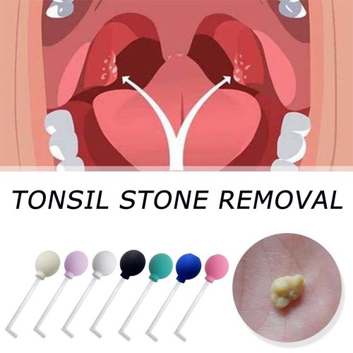 Tonsil Stone Removal Tool Manual Style Cleaner Remover Mouth Tonsil CleaningKit eBay