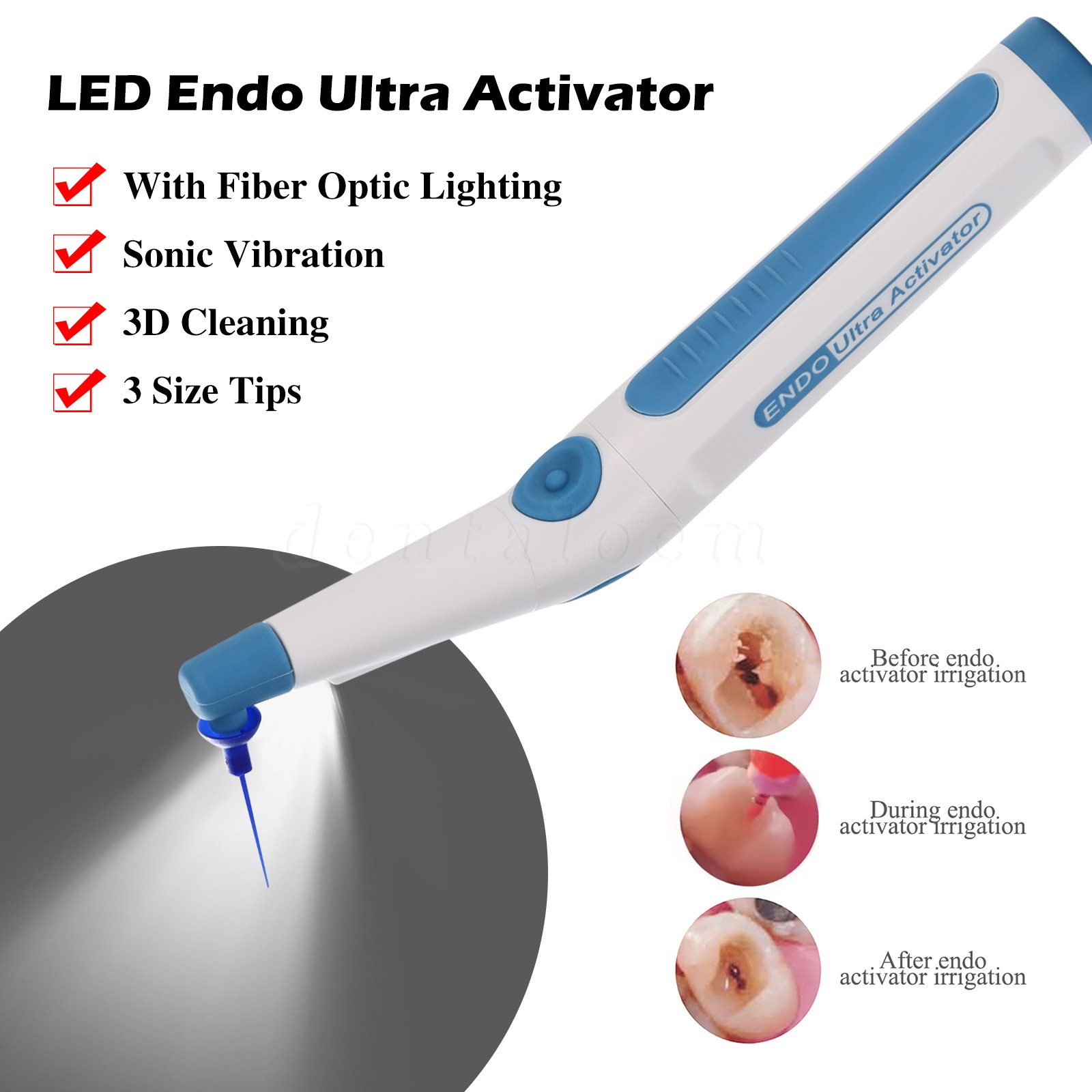 Dental Endodontic Endo Activator Sonic Endo Ultra Irrigator Root Canal 150 Tips