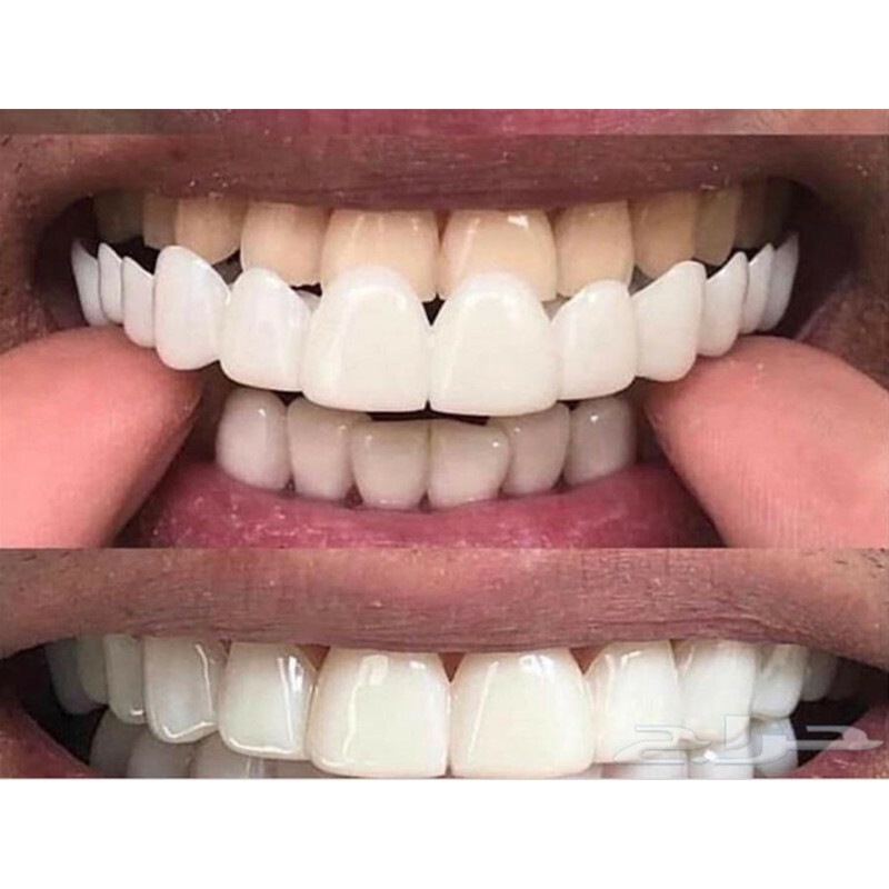 Facettes Dentaires Supérieures Et Inférieures - Fausses Dents Blanches, Dentier Cosmétique, Neuf