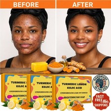 Kojic Acid Soap Dark Spot Whitening Turmeric Skin Bleaching Lightening 4oz - 3PK