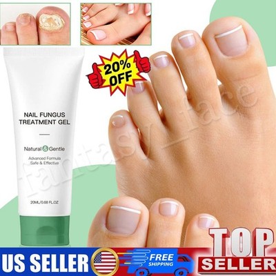 Nutraboost Nail Fungus Treatment Gel, Nail Fungus, Fungus Cream (1PCS)