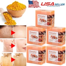Tumeric Soap Skin Whitening Dark Spots lightening Acne Brightening Turmeric USA