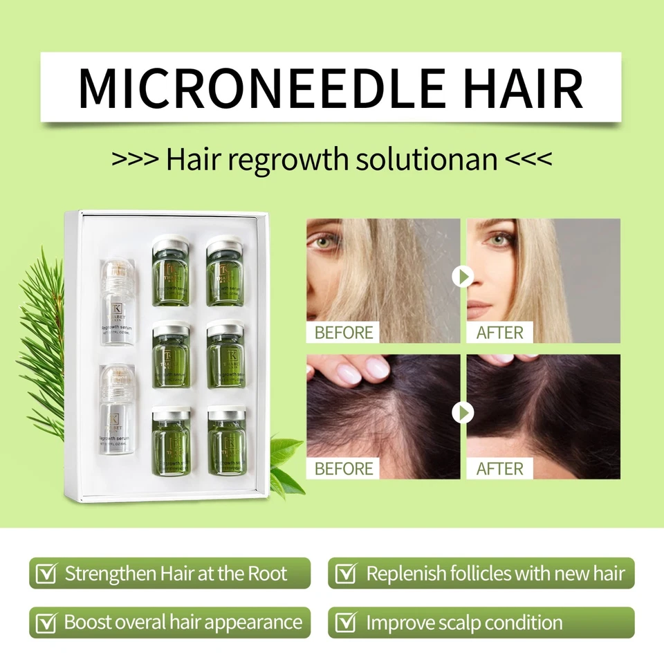 Infuse Hair Regrowth System, Advanced Hair Growth Treatment  USA Brand FAST Ship - Image 2 of 4