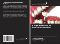 Vishal Tapadiya (U. A.) | Carga Inmediata De Implantes Dentales | Taschenbuch