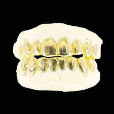 Custom Solid Gold Grillz
