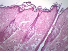 Hair Follicle - Prepared Slide - 75x25mm - Eisco Labs