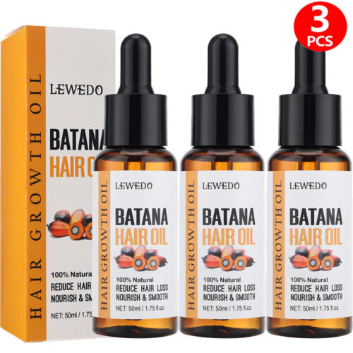 Batana Oil For Hair Growth, Pure Natural Botana Oil Cream Hair Loss Treatment - Picture 30 of 36