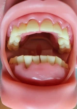 Nissin P15DP-TR.56D.1-OR Dental Model GSD Gingiva Typodont – New Open Box