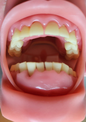 Nissin P15DP-TR.56D.1-OR Dental Model GSD Gingiva Typodont   New Open Box