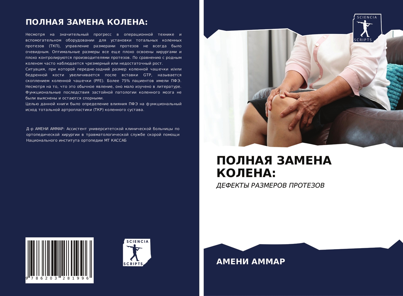 Thumbnail - Ameni Ammar | Polnaya Zamena Kolena: | Taschenbuch | Russisch (2021) |