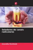 Seladores De Canais Radiculares Anuradha Wankhade Taschenbuch Portugiesisch 2022