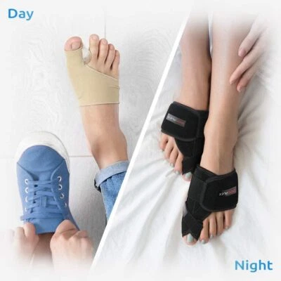 DOEPLEX Bunion Corrector Kit (7Pcs) Bunion Splint, Toe Straightener, Sleeve Pain Relief