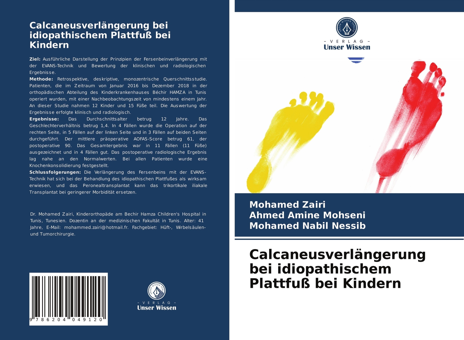 Thumbnail - Calcaneusverlängerung Bei Idiopathischem Plattfuß Bei Kindern Zairi