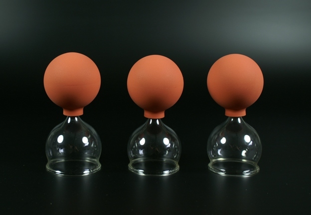 3er Schröpfset m. Ball 3x 50mm,Schröpfglas,Schröpfgläser Original Lauschaer Glas