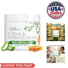 Eczema Psoriasis Cream Manuka Honey Aloe Vera pH Balanced Dry Itchy Skin Relief