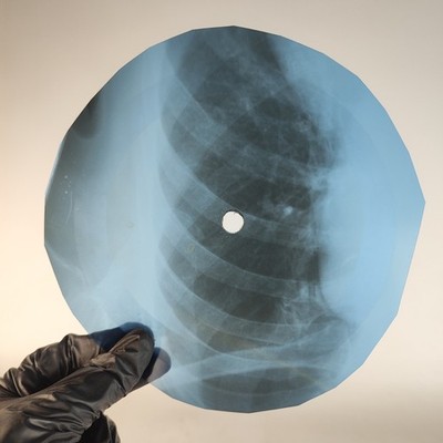 NINA SIMONE FEELING GOOD X-Ray USSR Record Roentgen Bone Ribs Music Vinyl