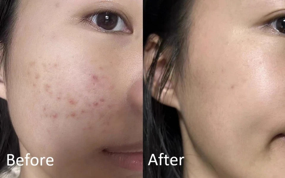 ETUDE SoonJung Panthenoside 10 Cica Balm 50ml – Soothing Hydrating Cream - Image 3 of 4