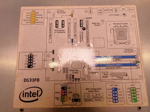 Philips HD11 XE PC 453561400941 mit EKG-Modul - Bild 7 von 17