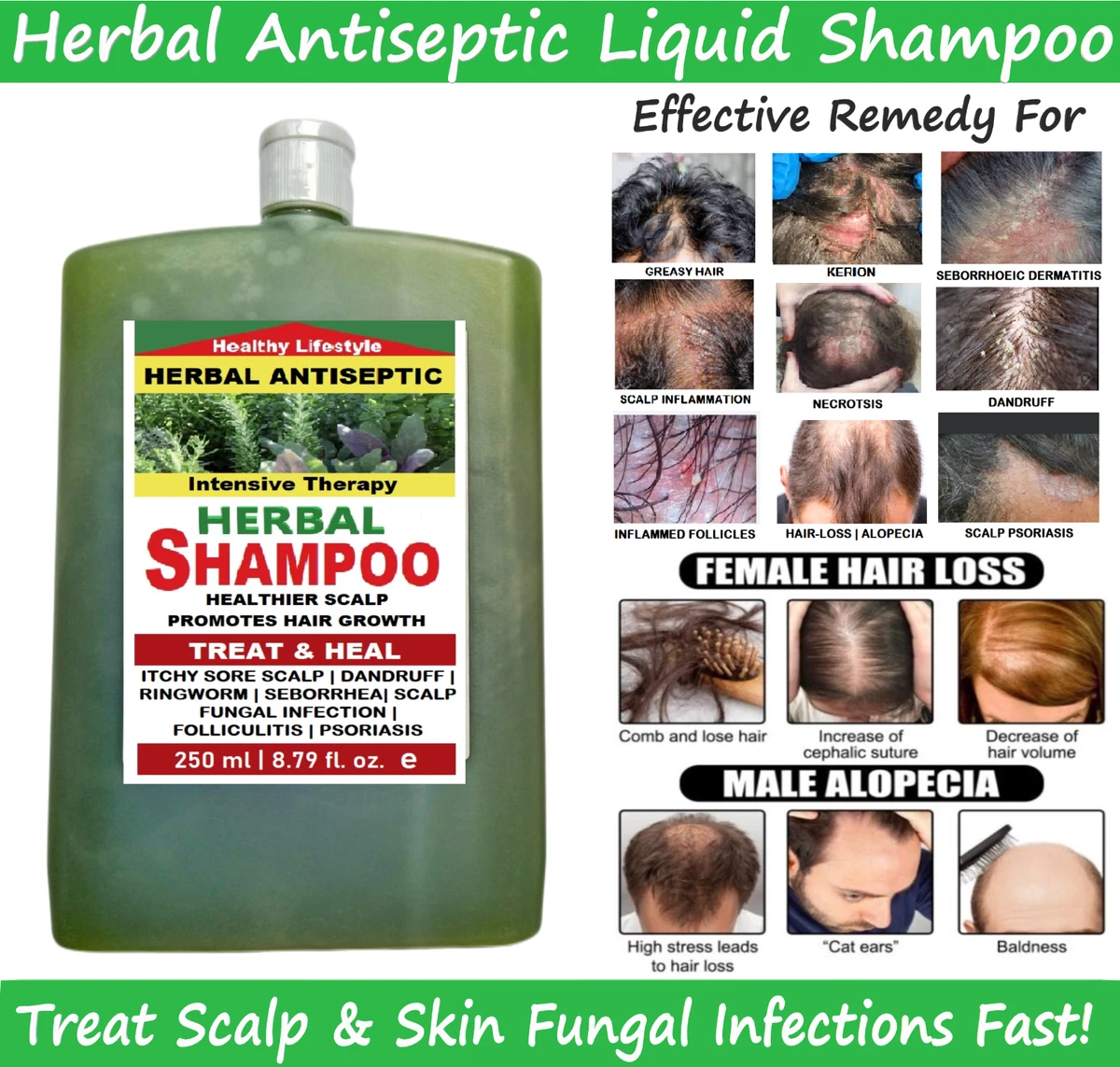 Shampoo cheap for eczema