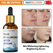 Hyaluronic Acid Serum 1 fl oz - Hydrating Skin, Wrinkles and Dark Spot Corrector