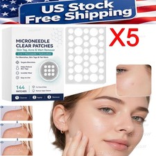 5BOX Microneedle Patches 144pcs, Skin Tag Wart Acne Remover Patches US STOCK