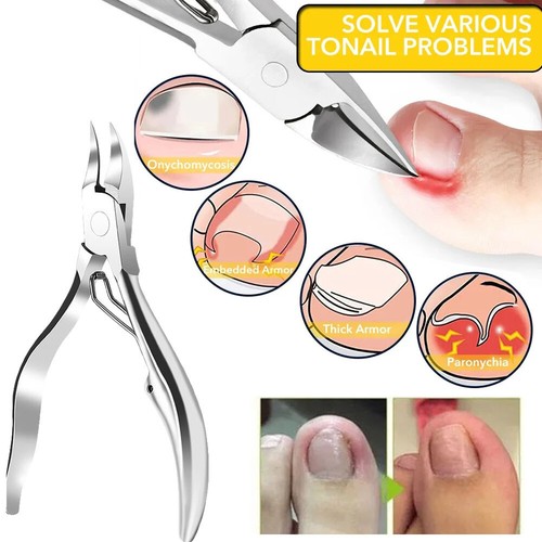 Cuticle Scissors Pedicure Nail Ingrown Nipper Toenail Cutter Dead Skin Remove - Picture 11 of 17