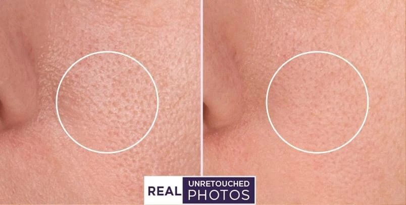 RETINOL VITAMIN A 5% + HYALURONIC ACID + Vitamin E - WRINKLE SERUM / CREAM - Image 4 of 4