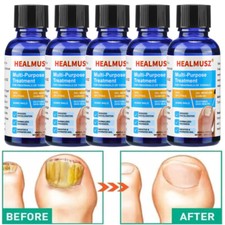 5/3x Extra Strong Nail Fungus Treatment Serum Essence Oil Feet Nails Repair Care