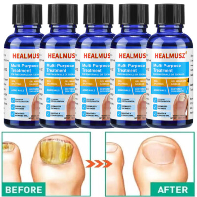 5/3x Extra Strong Nail Fungus Treatment Serum Essence Oil Feet Nails Repair Care