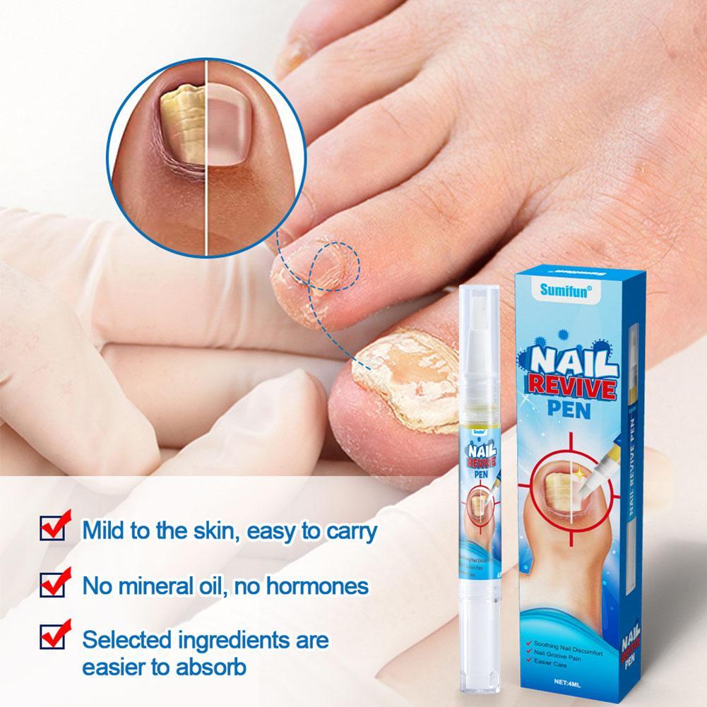 Sumifun Nail Fungus Treatment Pen 4ml Soothes Discomfort & Revives Nails | US
