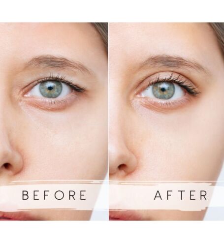 Eyelid lifting strips size XL, 144 pcs. - Picture 2 of 6