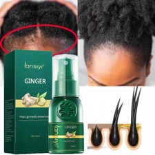 Hair Growth Dense Ginger Serum Anti-Loss Treatment Essence Spray Women Men 30ml
