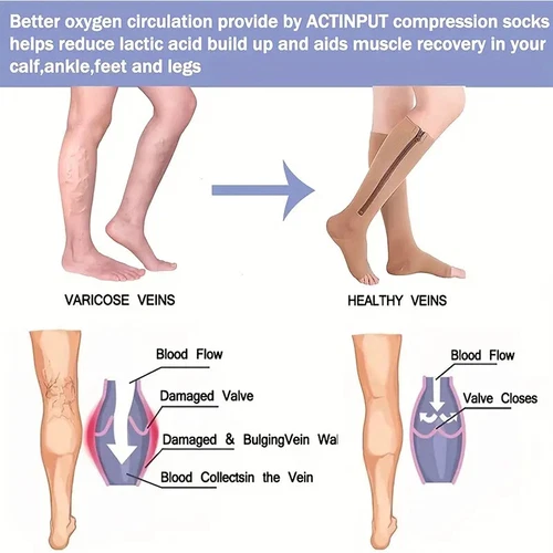 Pair Medical Compression Socks Varicose Knee Vein Open Toe Support Stockings - Bild 10 von 50