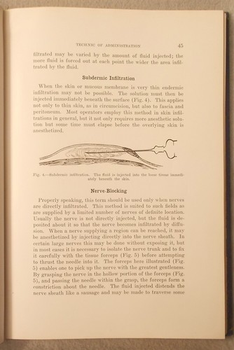 Vintage THE TECHNIC OF LOCAL ANESTHESIA Arthur Hertzler ANESTHESIOLOGY - Imagen 4 de 8