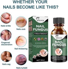 BEST Fungal Nail Treatment Liquid HIGHLY EFFE...