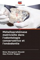 MéTalloprotéInase Matricielle Dans L'odontologie Conservatrice Et L'endodontie