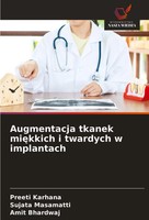 Preeti Karhana (U. A.) | Augmentacja Tkanek Mi¿Kkich I Twardych W Implantach