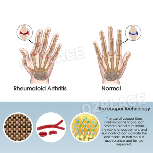 Arthritis Gloves Compression Joint Finger Hand Wrist Support Brace Pain Relief - Picture 9 of 14