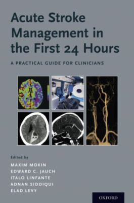 Acute Stroke Management in the First 24 Hours: A Practi - Paperback / softback N