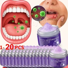1-20PCS Dental Restoration Mineral Powder, Mineral Tooth Powder, Teeth Whitening