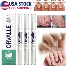 3PCS Orville Nail Fungus Pen Anti Fungus Infection Nail Care Repair Pen Toenail