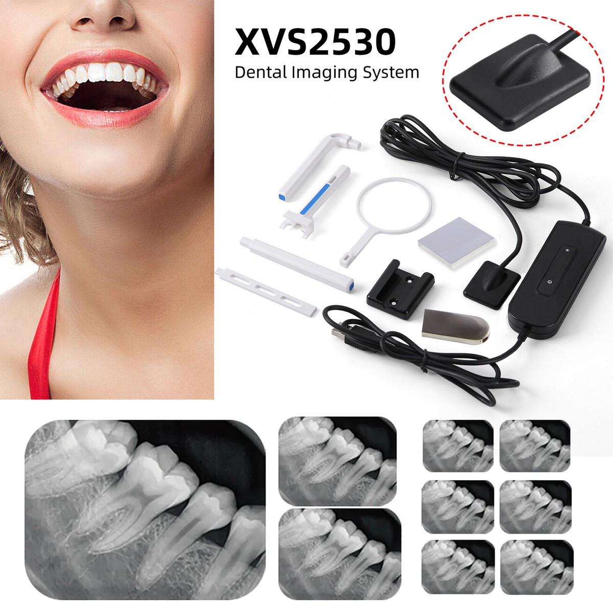 Dental Xray Digital Imaging System Xray /RVG X-Ray Sensor