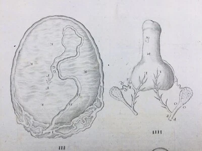 Gynécologie en 1741 Obstétrique Rare Gravure Médicale Médecine Placenta - Photo 1/4