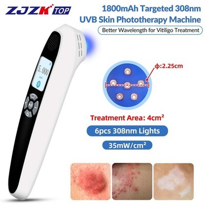 308nm Handheld Light Precise UVB Phototherapy for Skin Disorders 35mW/cm² 6Diode