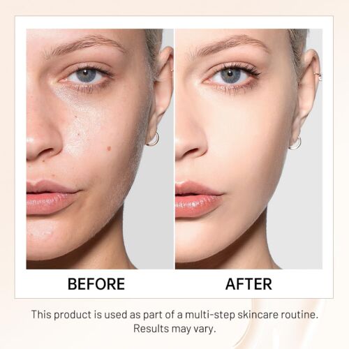 4-in-1 Liquid Foundation with SPF 50+ - Full Coverage, Hydrating, Waterproof - Picture 5 of 7