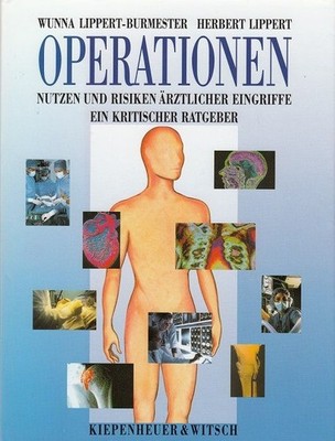 Operationen - Nutzen und Risiken ärztlicher Eingriffe Lippert-Burmester, Wunna u