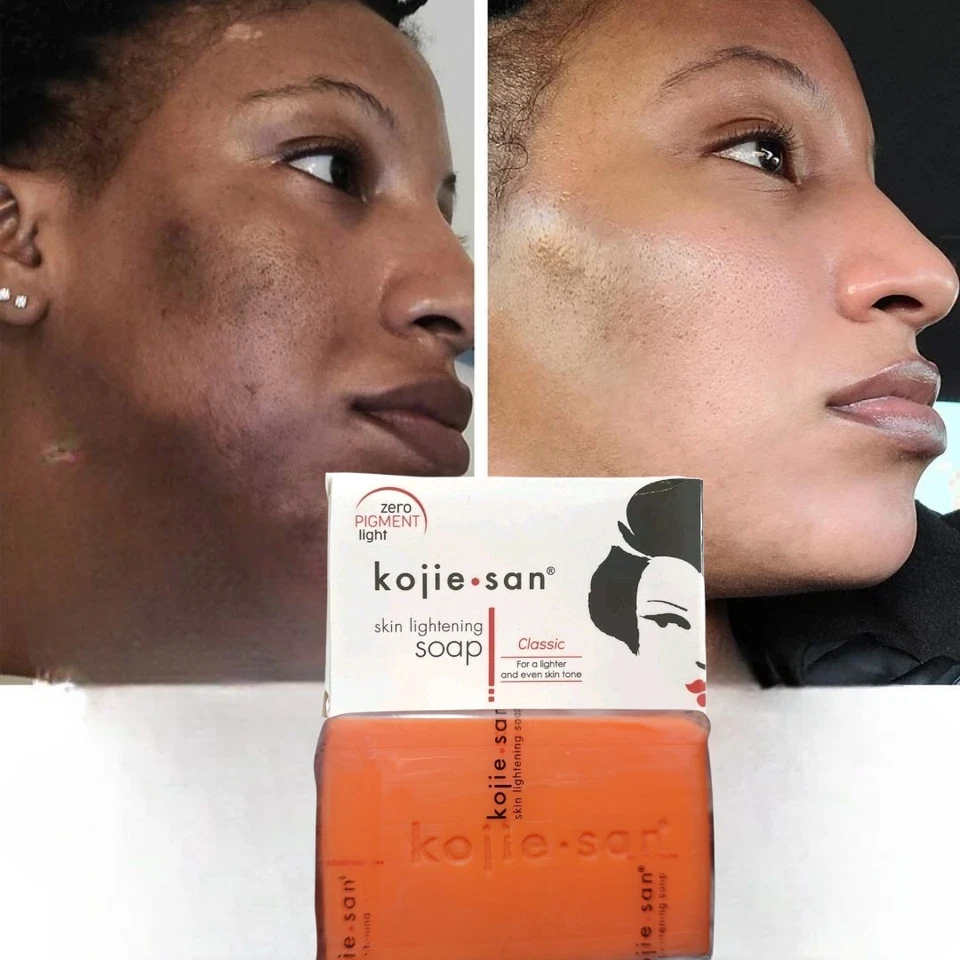 [4 peças] Sabonete em barra clareador de pele Kojie San ácido kójico sabonete corporal original, 135g  - Imagem 2 de 4