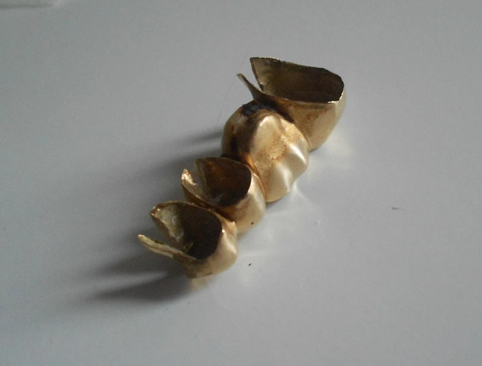 Zahngold Altgold Bruchgold 11Gramm - Bild 4 von 4