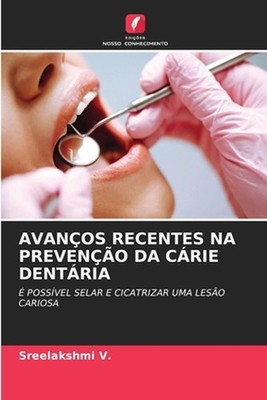 Avanos Recentes Na Preveno Da Crie Dentria by Sreelakshmi V. (Portuguese) Paperb