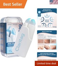 Advanced Skin Tag Remover - -Cleared Device - Only for Skin Tag Removal - Wor...